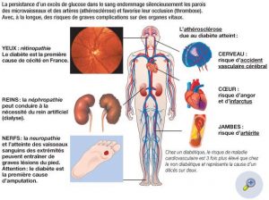 Glucose